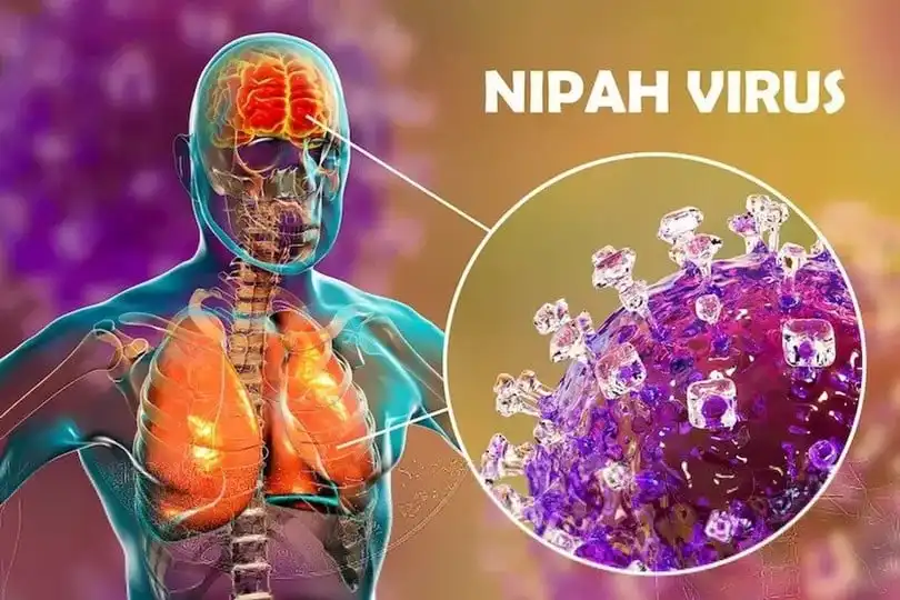 Virus Nipah: Un Riesgo Bajo pero Preocupante para la Salud Pública